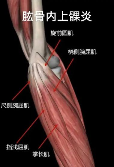 高尔夫球的右肘状态
