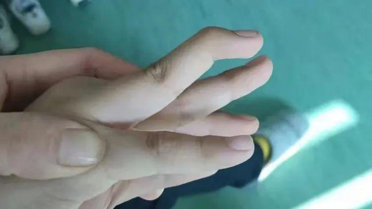 高尔夫球左手伸不直的原因及解决方法