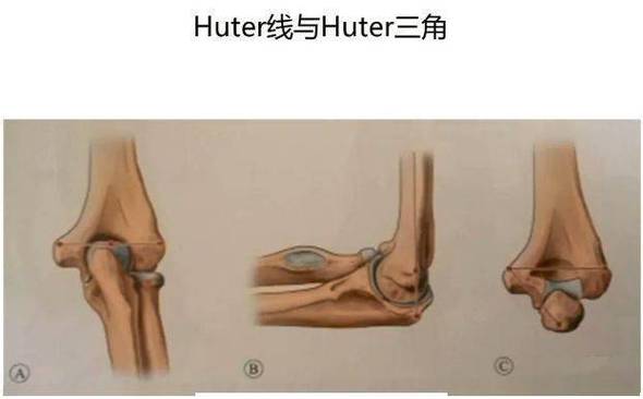 高尔夫球肘实验步骤