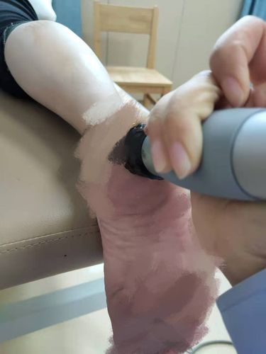 高尔夫球肘疼痛的原因和治疗方法