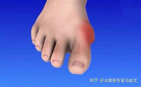 高尔夫脚怎么站