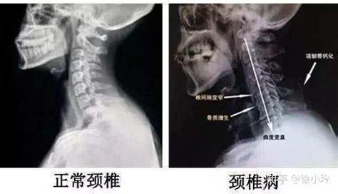 健康之路2020视频颈椎