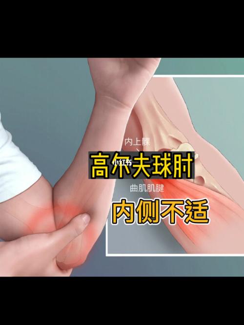 高尔夫球肘擦什么药