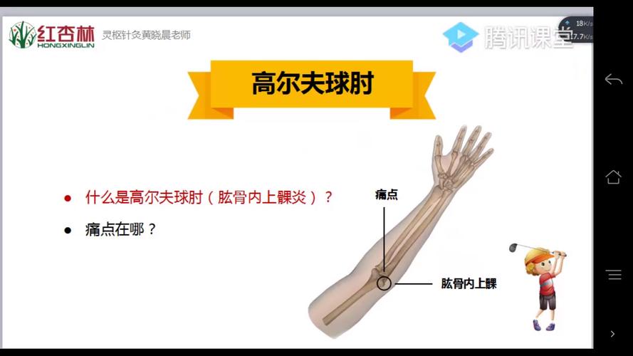 高尔夫球肘去中医院挂什么科