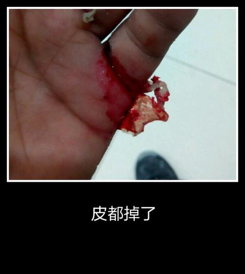 高尔夫球切开