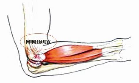 高尔夫肘名词解释