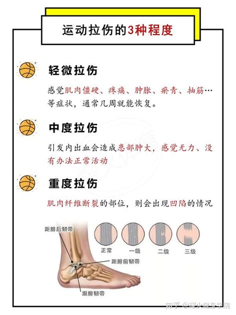 打高尔夫球后背肌肉酸痛