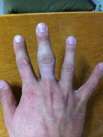 打乒乓球手关节疼