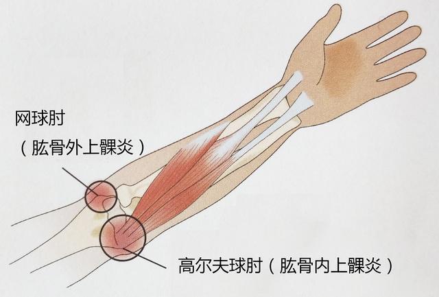 哪些动作容易伤到高尔夫球手？